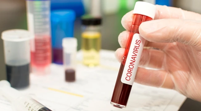 Coronavirus, svolta con lo studio dell'Ospedale Sacco: "C'è una deriva genetica con importazioni multiple"