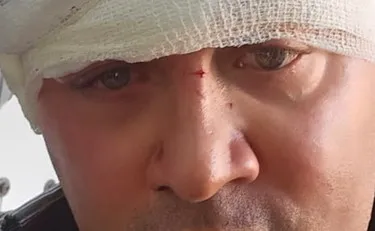 Firenze, capogruppo della Lega aggredito da un immigrato: pugni e insulti