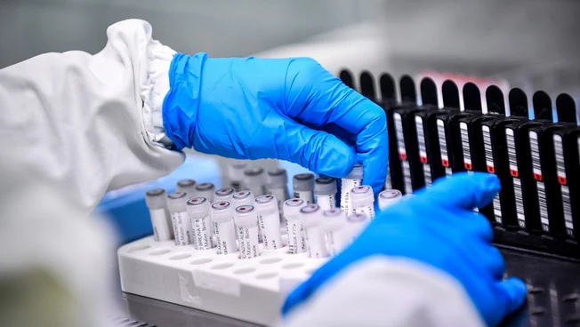 Coronavirus, caso di Ferrera Erbognone: il comune lombardo senza positivi. "Studio sul sangue dei cittadini"