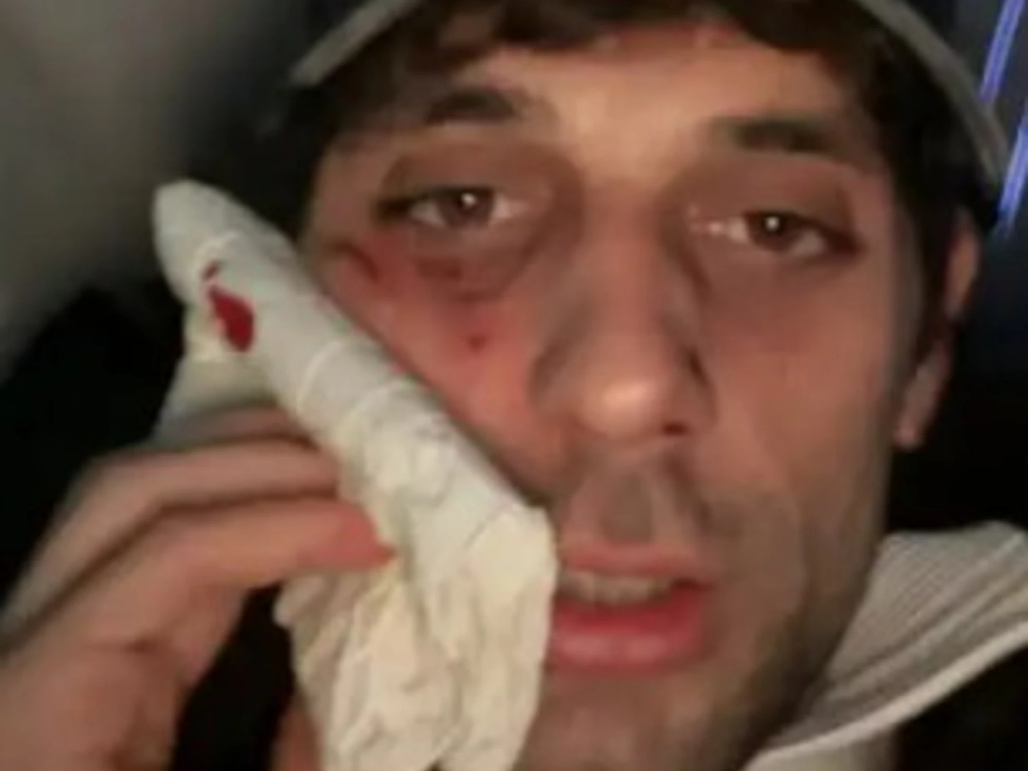 Bresh ridotto così, lividi e sangue: cosa è successo?