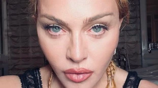 Madonna, "stanca e debole, non ha le forze": come sta davvero
