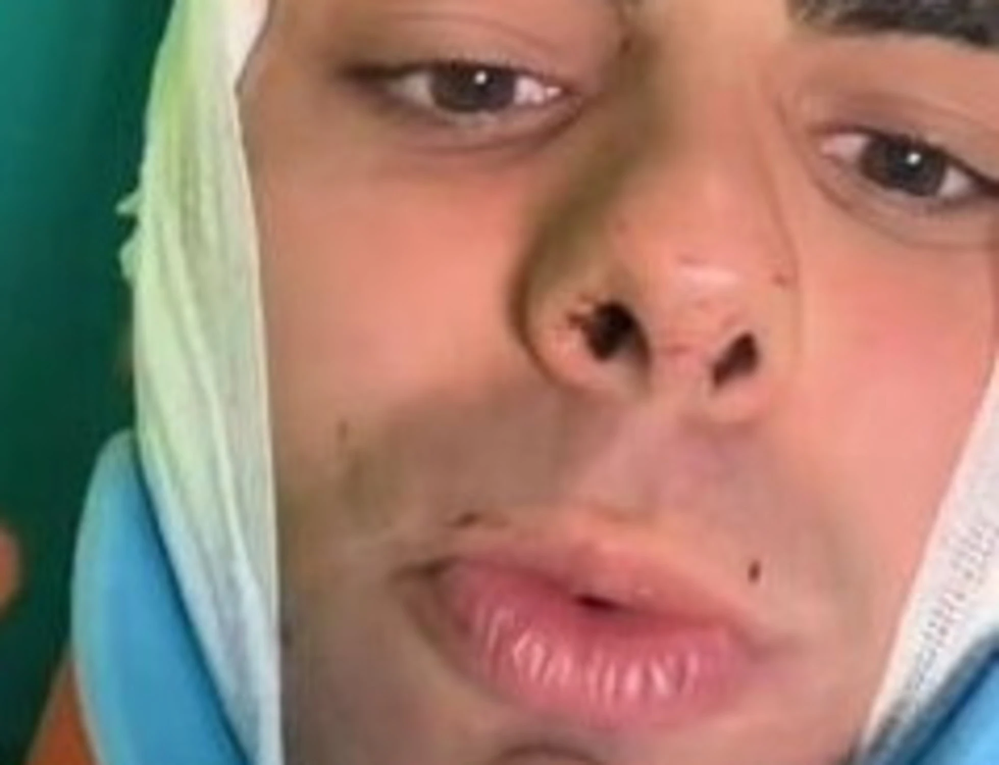 Milano, 25enne massacrato per un orologio: "Un altro colpo e sarei morto"