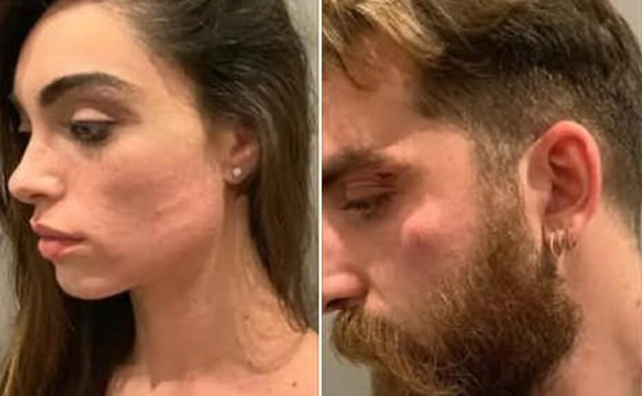 Lorella Boccia e il figlio di Lucio Presta pestati e derubati: "Vigliacchi e uomini di m***"