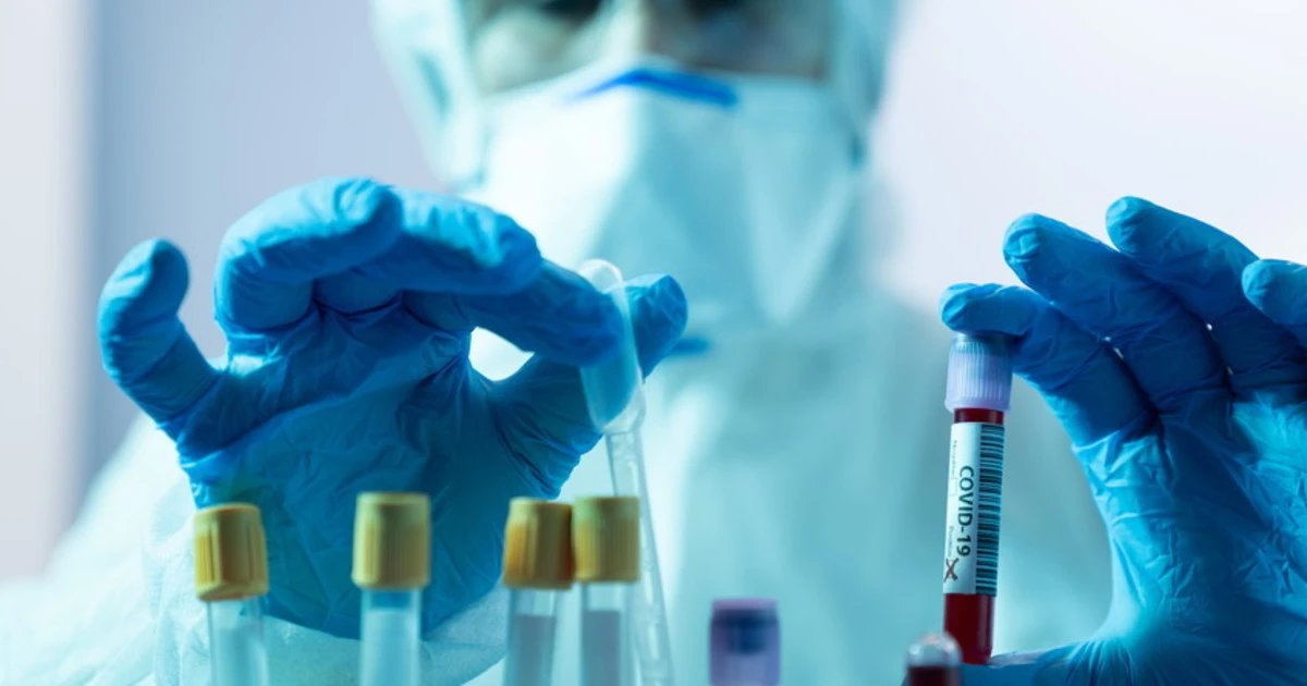 Covid-19 , in laboratorio il virus per infettare tutti: "Contagio intenzionale", ecco a cosa stanno pensando per uscirne