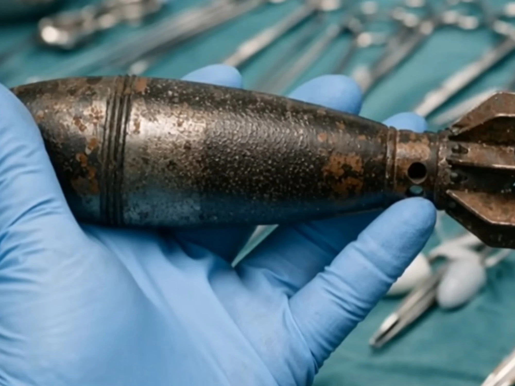 Tolosa, in ospedale con una bomba nel retto: il gioco erotico finisce in tragedia