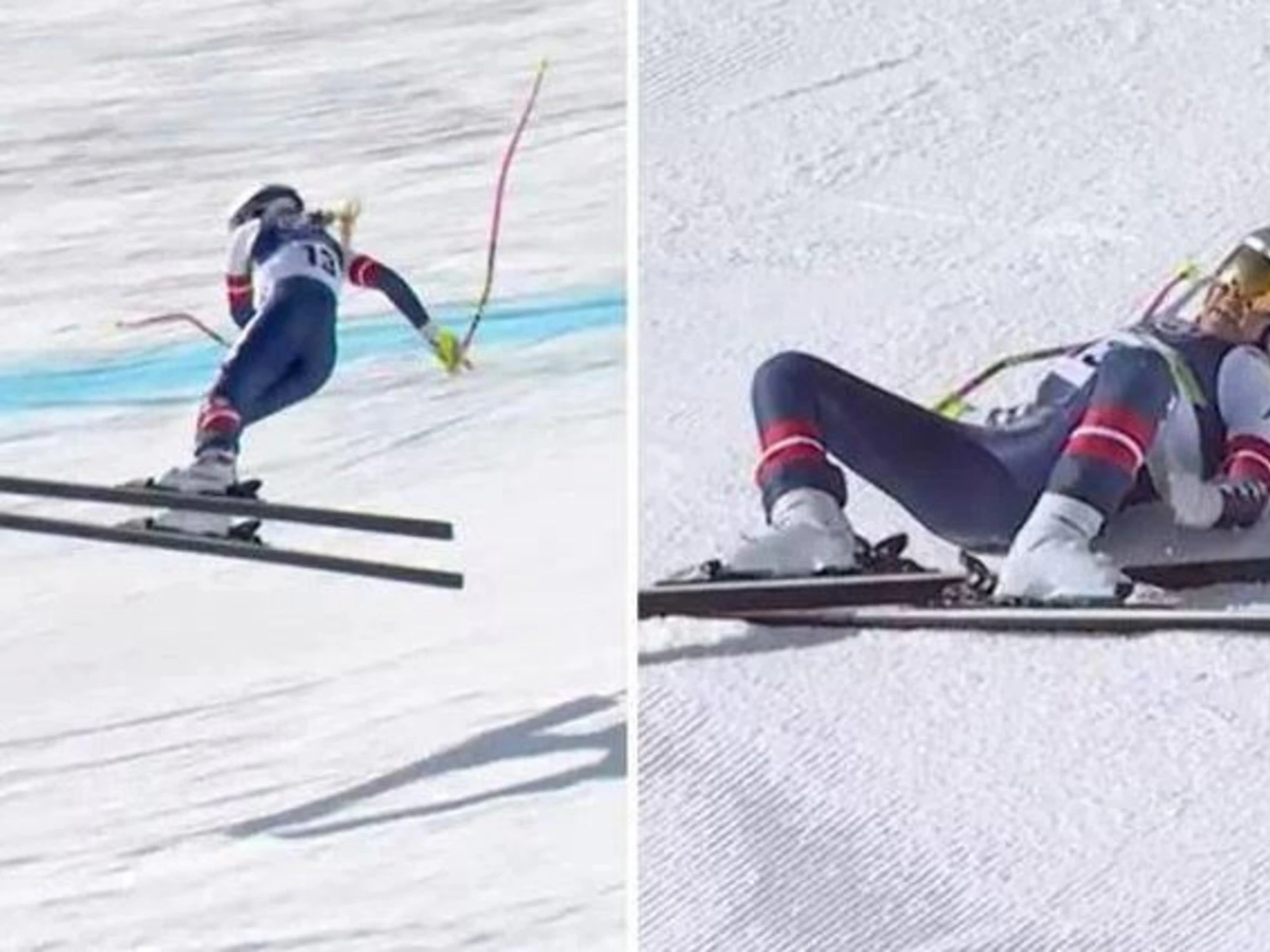 Milano-Cortina, la verità sul dramma di Lindsay Vonn: "Il crociato non c'entra"