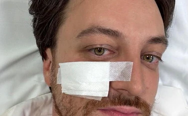 Alberto Stefani, incidente stradale mentre andava al consiglio federale della Lega