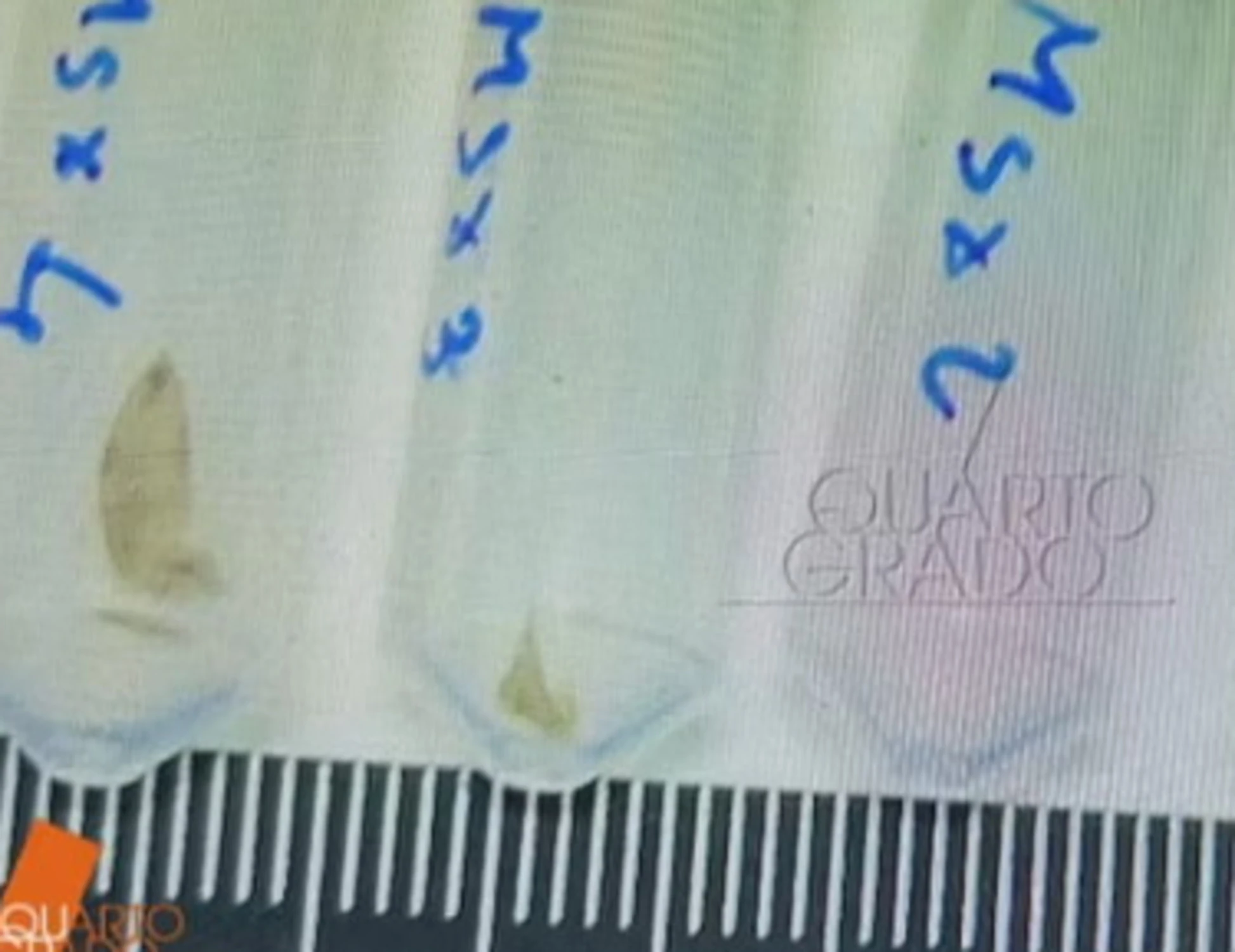 Garlasco, il giallo della provetta: "Sparita la decima unghia di Chiara Poggi"