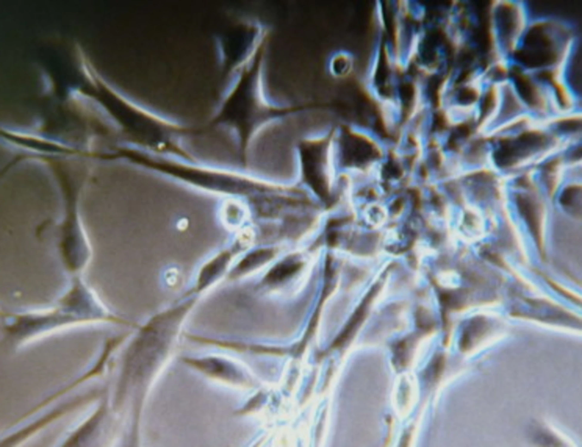 Cancro, come ha trasmesso il tumore a 18 figli