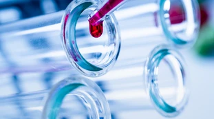 Coronavirus, guerra di spie tra Russia e Occidente. Lo scenario: "Vogliono mettere le mani sul vaccino per distruggerlo"