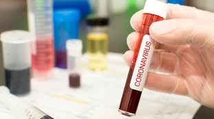 Coronavirus, "indagine-lampo" sulle varianti. Rumors dal ministero della Salute: troppi morti in Italia, un terribile sospetto