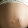 Usa: più ragazze madri