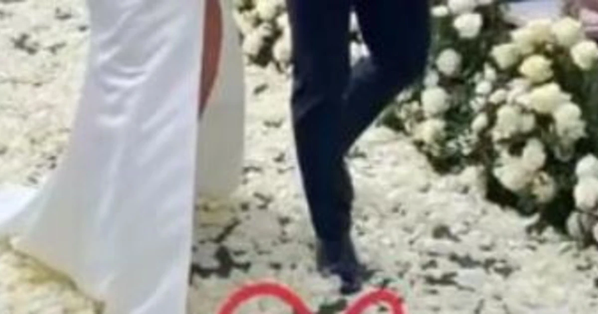 561x177