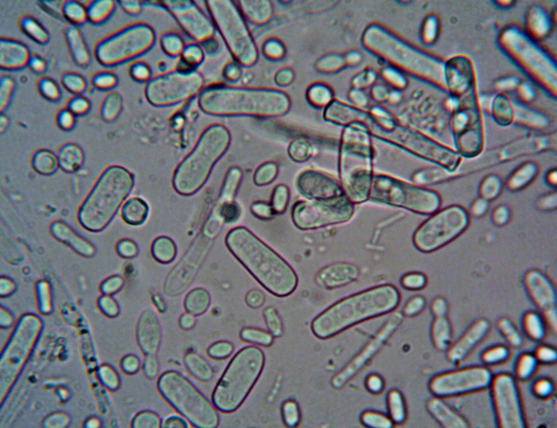 Caldo anomalo, spopola il vibrio: il batterio infetta i nostri mari, i sintomi e i gravi rischi